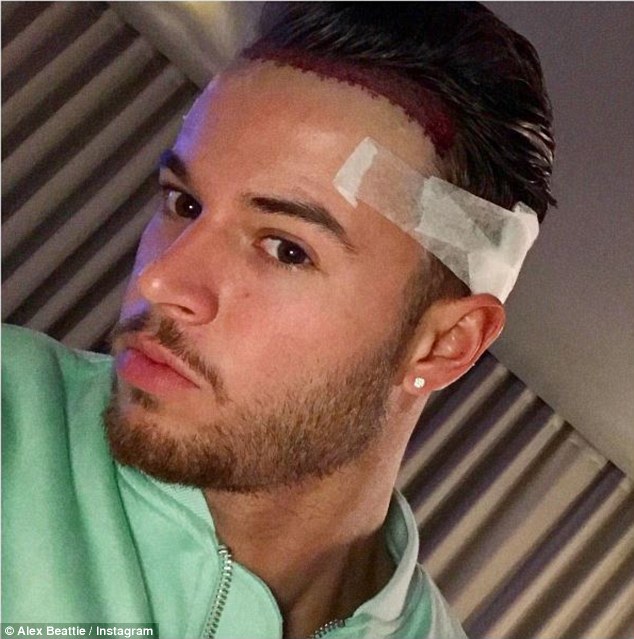 Oh dear: The personal trainer revealed his bloodied hairline after the surgery, which was later bandaged up and left him with a 'swollen head'